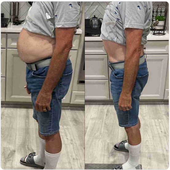 Men over 50 bloating and weight gain